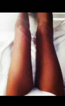 legs..