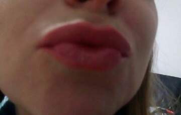Bacio