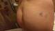 Morso nel culetto